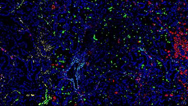 The Power of Advanced Multiplexed Imaging